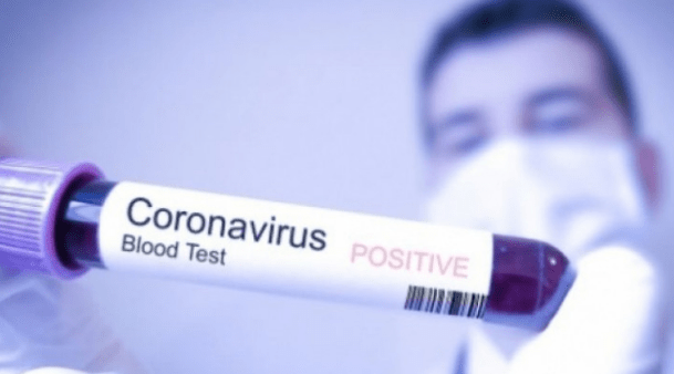 NOVI PACIJENT – 132. u BiH sa koronaviriusom